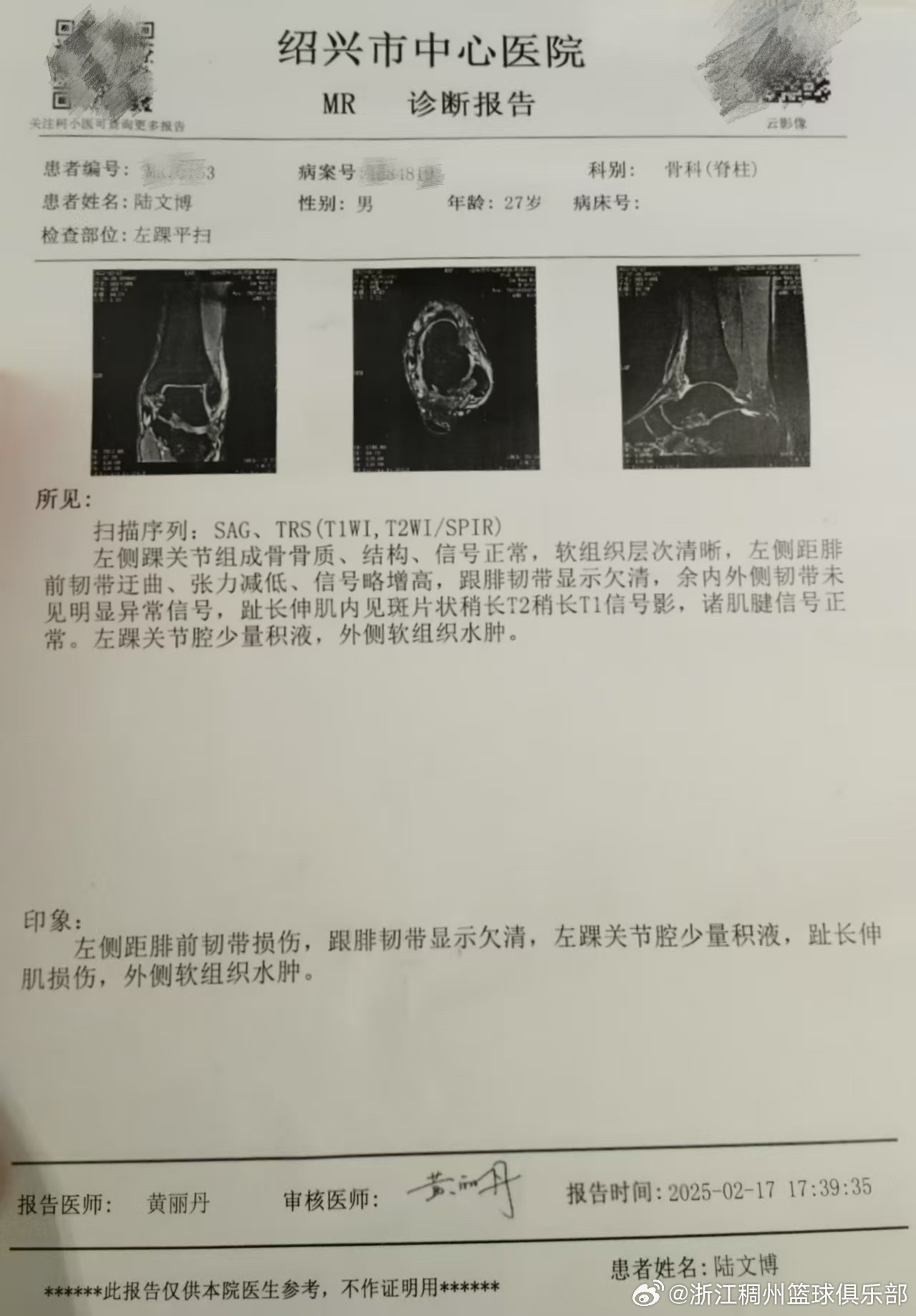 进攻